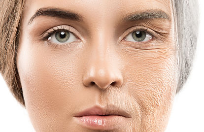 Close-up portrait from the laser treatment page