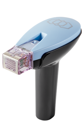 Morpheus8 treatment image